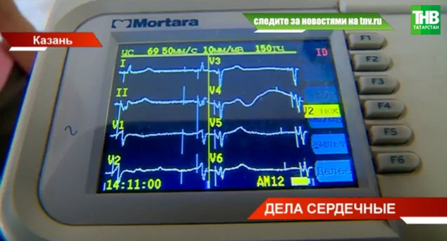 Кардиолог объяснил, когда низкий пульс опасен
