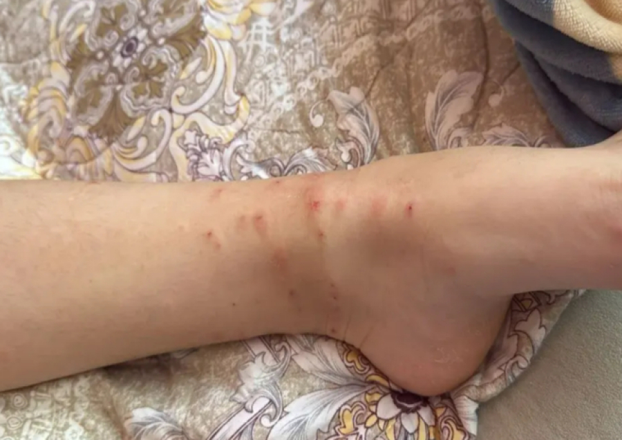 На нашествие блох жалуются жители одного из микрорайонов Актау